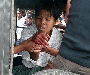 bomb_wounded_305px.jpg bomb_wounded_305px.jpg