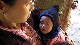 malaria_child_305px.jpg