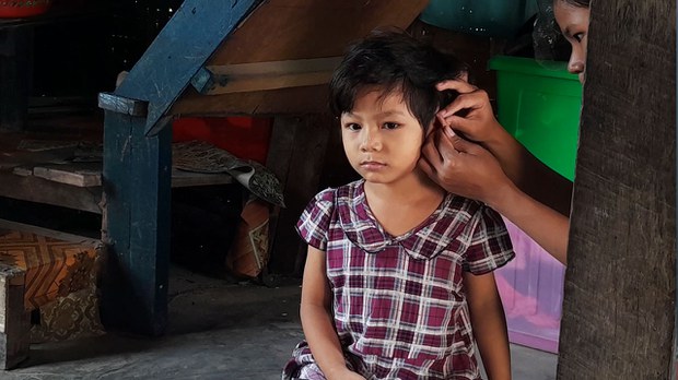 ကလေးမြို့က ဦးခေါင်းကျည်စထိမှန်ခံထားရတဲ့ကလေး မခွဲစိတ်နိုင်ဘဲ ဝေဒနာခံစားနေရ ကလေးမြို့က ဦးခေါင်းကျည်စထိမှန်ခံထားရတဲ့ကလေး မခွဲစိတ်နိုင်ဘဲ ဝေဒနာခံစားနေရ