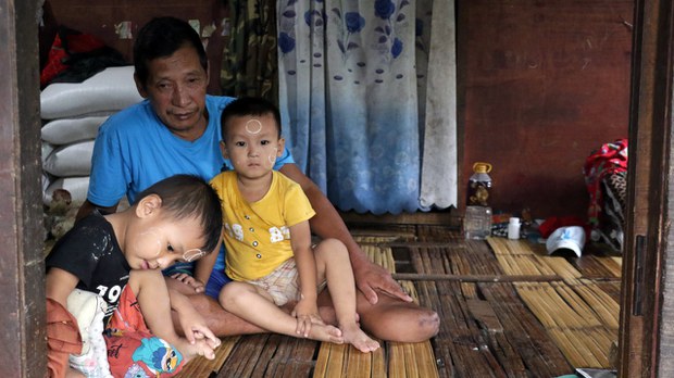 မြေမြှုပ်မိုင်းကြောင့် အသက် ၆၀ နီးမှ ဒုက္ခိတဖြစ်ရတဲ့ ကချင်အဘိုးအို မြေမြှုပ်မိုင်းကြောင့် အသက် ၆၀ နီးမှ ဒုက္ခိတဖြစ်ရတဲ့ ကချင်အဘိုးအို