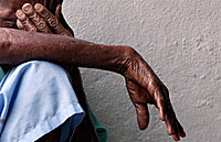 AIDS_patient_A_200px.jpg AIDS_patient_A_200px.jpg