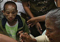 AIDS_patient_PPT_200px.jpg AIDS_patient_PPT_200px.jpg