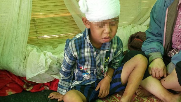 injured-child-kayah.jpg injured-child-kayah.jpg