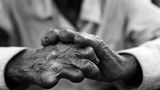 leprosy-305