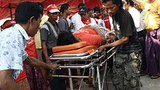 mechaungkan-injure-305.jpg