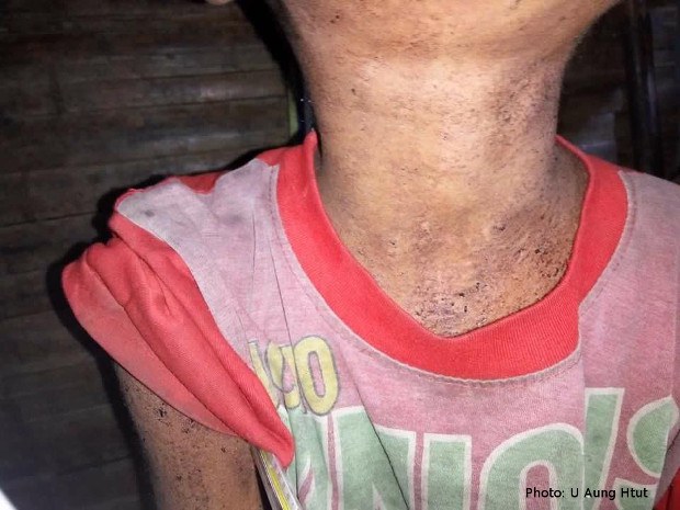 naga-disease-620.jpg naga-disease-620.jpg