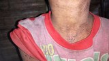 naga-disease-620.jpg