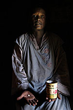 HIV_patient_150px.jpg HIV_patient_150px.jpg