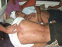 attack_victim2_200px.jpg