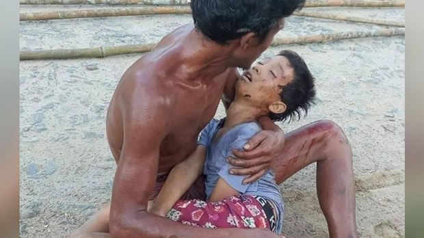 ရွှေကူမြို့နယ် မိုးစစ်ရွာမှာ လက်နက်ကြီးကြောင့် အရပ်သားသုံးဦး သေဆုံး၊ ငါးဦး ဒဏ်ရာရ ရွှေကူမြို့နယ် မိုးစစ်ရွာမှာ လက်နက်ကြီးကြောင့် အရပ်သားသုံးဦး သေဆုံး၊ ငါးဦး ဒဏ်ရာရ