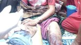 landmind-injure-622.jpg