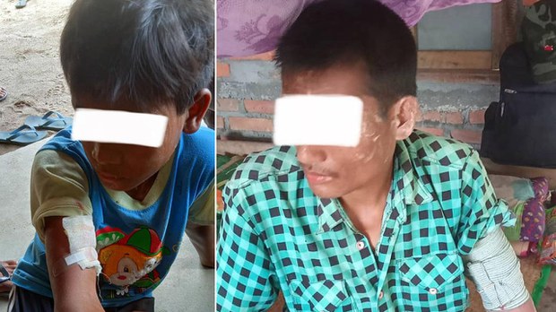 ကျောက်ကြီးနဲ့ မုန်းက ဒေသခံခြောက်ဦး လက်နက်ကြီးထိမှန်ဒဏ်ရာရ ကျောက်ကြီးနဲ့ မုန်းက ဒေသခံခြောက်ဦး လက်နက်ကြီးထိမှန်ဒဏ်ရာရ
