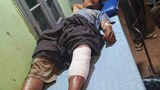 villager-injure-622.jpg