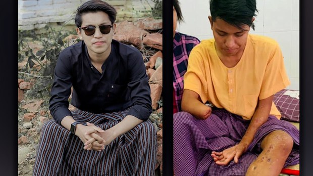 မျက်စိခွဲစိတ်ကုသခွင့်ရဖို့ မျှော်လင့်နေတဲ့ ကိုလျှံဖြိုးအောင် မိသားစု