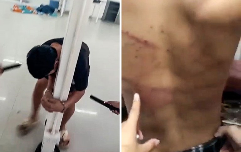 9-taser-torture ကိုစိုင်းကာစီနိုတွင် အလုပ်ခိုင်းစေခံရသည့် လာအိုလူငယ်တစ်ဦးအား တိုင်တွင်ကြိုးဖြင့်ချည်နှောင်ထားပုံ။ ကျောပြင်တွင် ရိုက်နှက်ခံထားရသည့် ဒဏ်ရာများကိုလည်း တွေ့ရသည်။ (Screenshots from video provided to RFA)