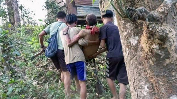 မင်းတပ်မြို့ ပန်းပါရွာ လေကြောင်းနဲ့အပစ်ခံရလို့ ကလေးတစ်ဦးအပါအဝင် သုံးဦးသေ မင်းတပ်မြို့ ပန်းပါရွာ လေကြောင်းနဲ့အပစ်ခံရလို့ ကလေးတစ်ဦးအပါအဝင် သုံးဦးသေ