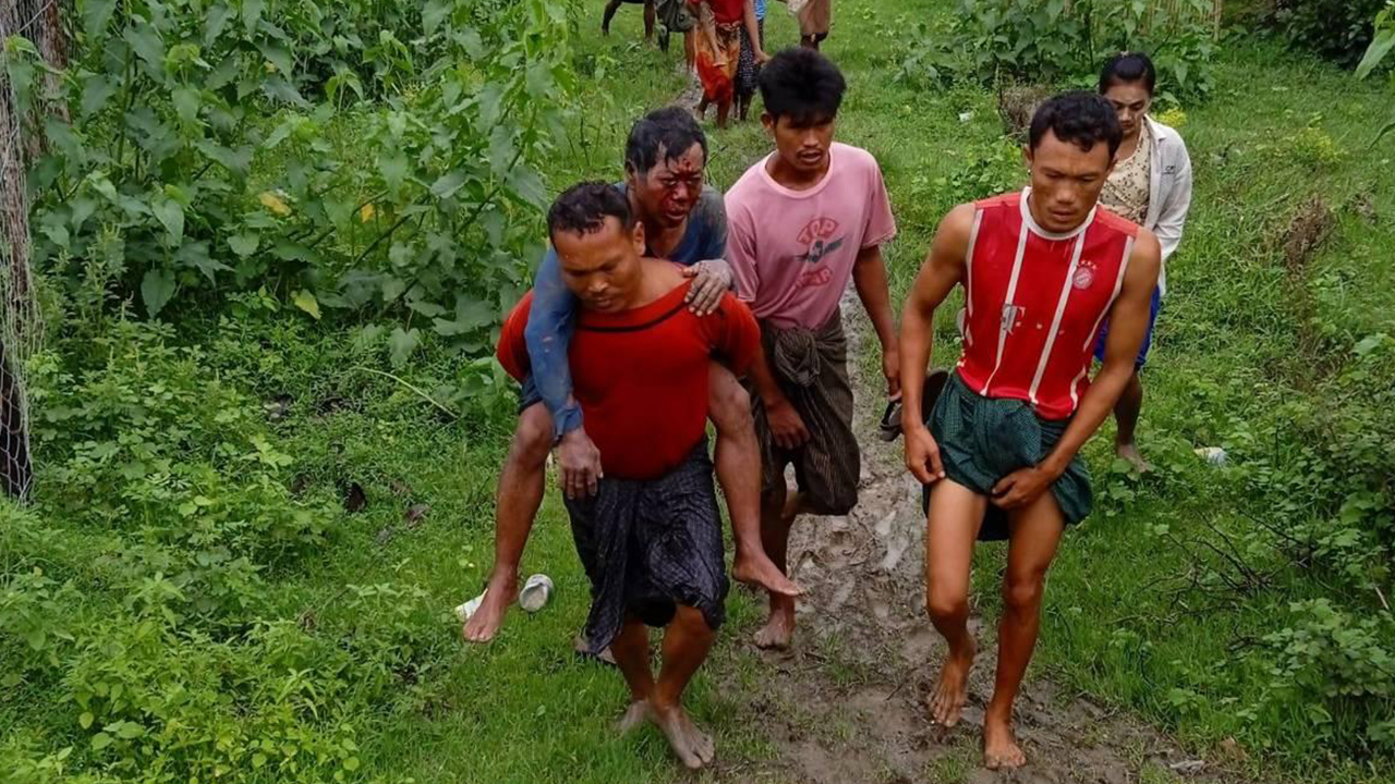 ရသေ့တောင်မြို့နယ် သာစည်ကုန်းကျေးရွာမှာ ၂၀၂၂ ခုနှစ် ဇွန်လ ၁၇ ရက်နေ့က မိုင်းထိဒဏ်ရာရသွားသည့် လူနာကို သယ်ဆောင်လာစဉ် (Photo: CJ)