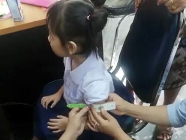 ສາກົລຊ່ອຍຫຼຸດຜ່ອນ ເດັກນ້ອຍ ຂາດສານ ອາຫານ