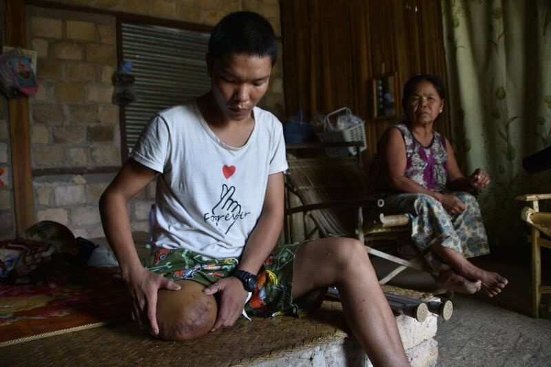 မိုင်းကြောင့် ခြေတစ်ဖက်ဆုံးရှုံးခဲ့သည့် ရေပူရွာမှ စိုင်းအောင်ကျန် ကို မိခင်နှင့်အတူ ၂၀၂၂ ခုနှစ် မေလ ၁၃ ရက်နေ့တွင် တွေ့ရစဥ် (Photo: RFA)