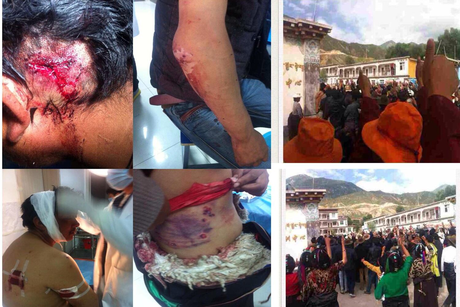 གདན་མ་ཕྱོགས་ཀྱི་ས་གནས་བོད་མི་ཚོས་སྡེ་དཔོན་གློད་བཀྲོལ་དགོས་བའི་དགོས་འདུན་བཏོན་བཞིན་པ། ༢༠༡༤།༨།༡༢