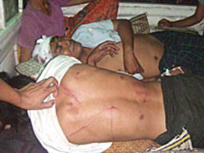 attack_victim2_200px.jpg