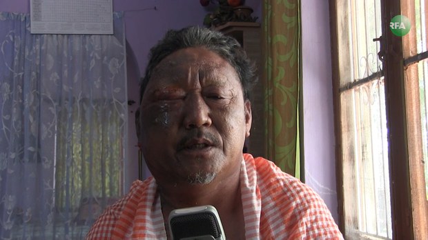 བདམས་ཐོན་སྤྱི་འཐུས་རྣམས་མཐུན་སྒྲིལ་རྡོག་རྩ་ཆིག་སྒྲིལ་ཡོང་ཆེད་རང་ལུས་མེར་སྲེག་བཏང་བ་ཡིན་ཟེར།
