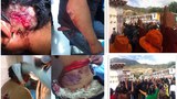 གདན་མ་ཕྱོགས་ཀྱི་ས་གནས་བོད་མི་ཚོས་སྡེ་དཔོན་གློད་བཀྲོལ་དགོས་བའི་དགོས་འདུན་བཏོན་བཞིན་པ། ༢༠༡༤།༨།༡༢