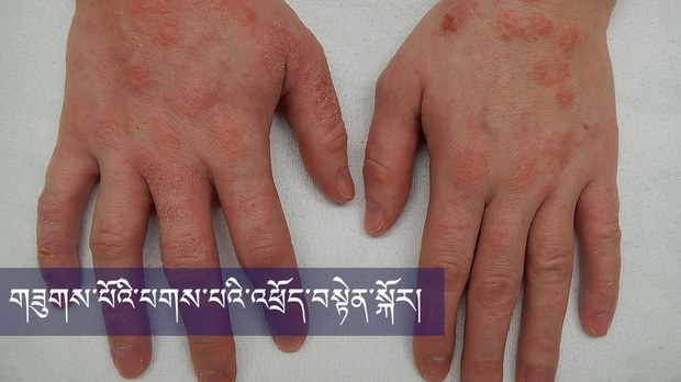 གཟུགས་པོའི་པགས་པའི་འཕྲོད་བསྟེན་སྐོར། གཟུགས་པོའི་པགས་པའི་འཕྲོད་བསྟེན་སྐོར།