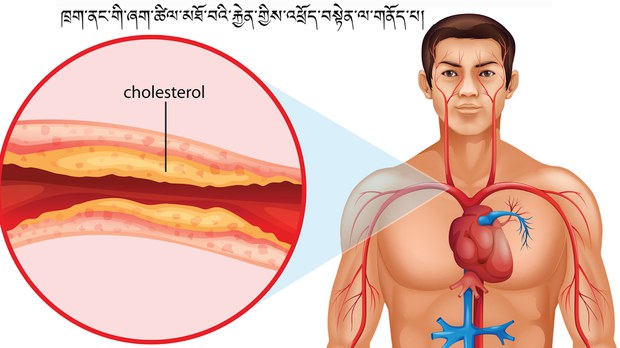 ཁྲག་ནང་གི་ཞག་ཚིལ་མཐོ་བའི་རྐྱེན་གྱིས་འཕྲོད་བསྟེན་ལ་གནོད་པ།